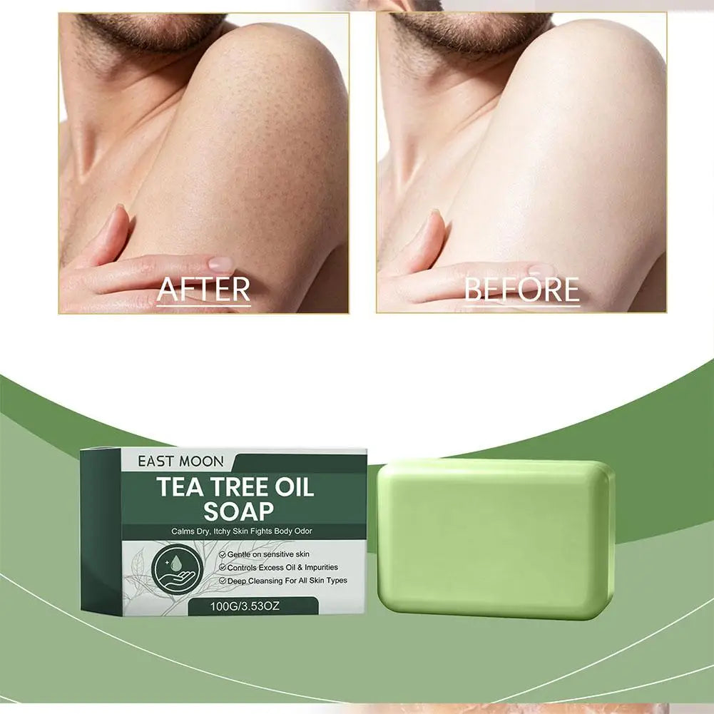 Tea Tree Soap Natural Soaps For Body & Face Skin Cleaning Natural Skin Cleanser Gentle Exfoliating Bar Soap For Oily Dry Skin